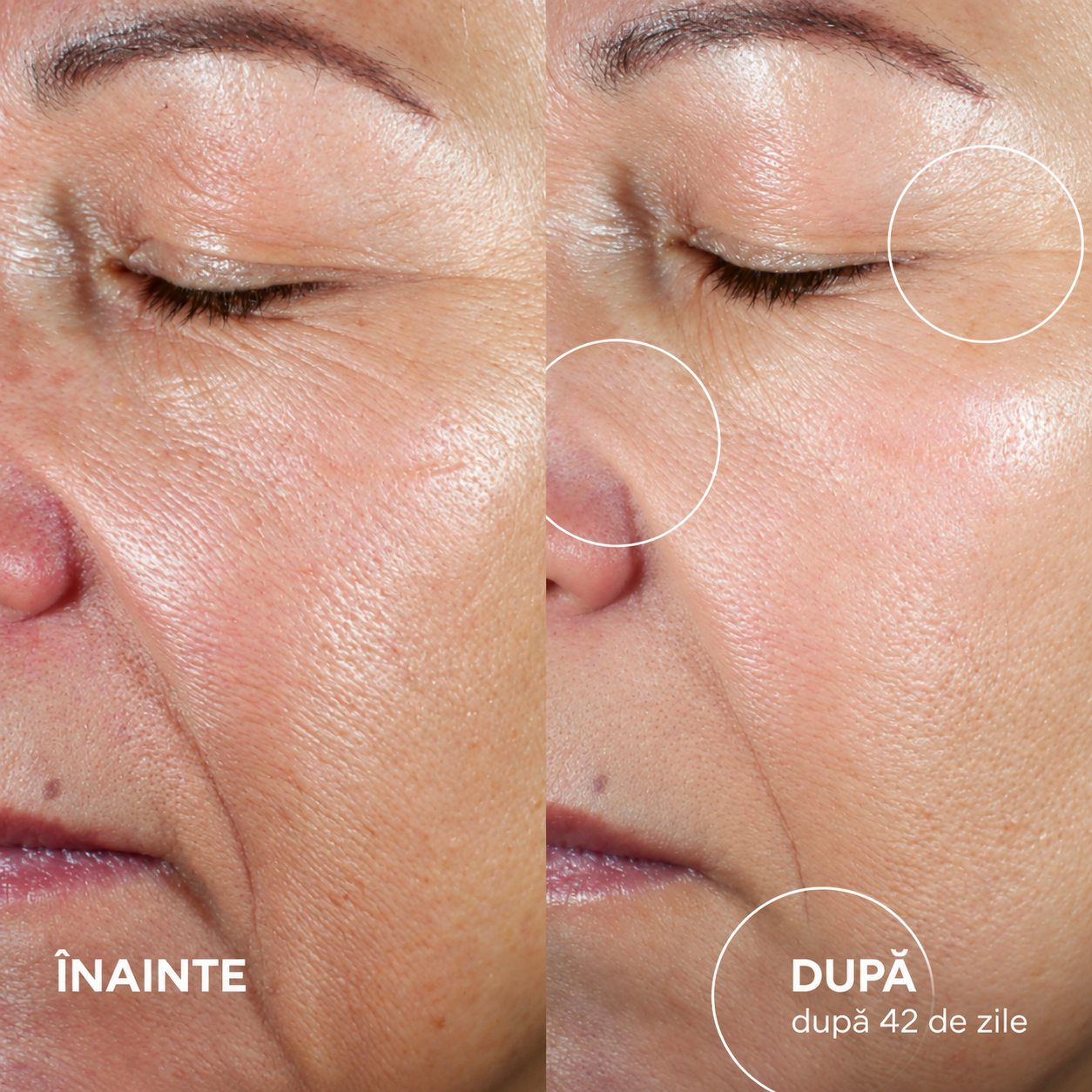Ser facial anti-aging comparatie sa Ser facial anti-aging